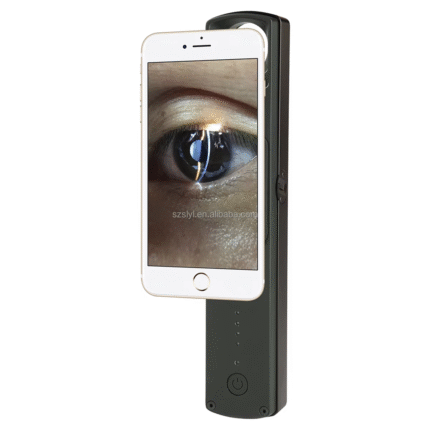 Ophthalmic Disease Diagnostic Equipment Ultra-long Standby S150 Optical Handheld Slit Lamp Portable